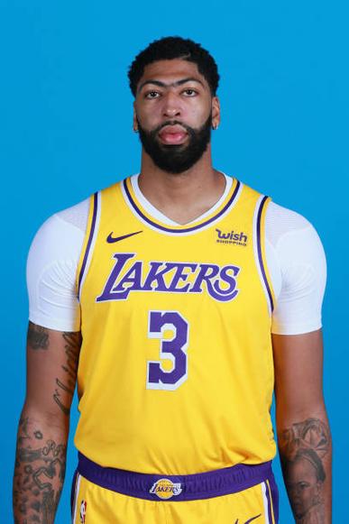 浓眉出席媒体日右边眼睛明显异常 医生告知剩余生涯都要戴眼镜