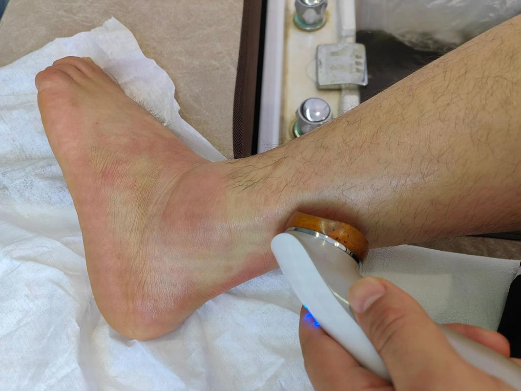 今天复出！科内特：此前崴了脚踝&肩膀轻微劳损 花了点时间恢复